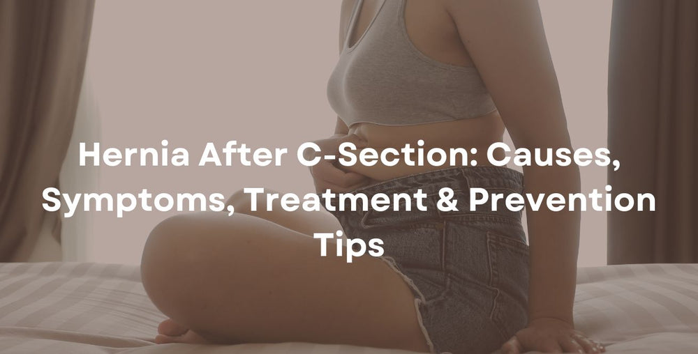 Hernia After C-Section Causes, Symptoms, Treatment & Prevention Tips