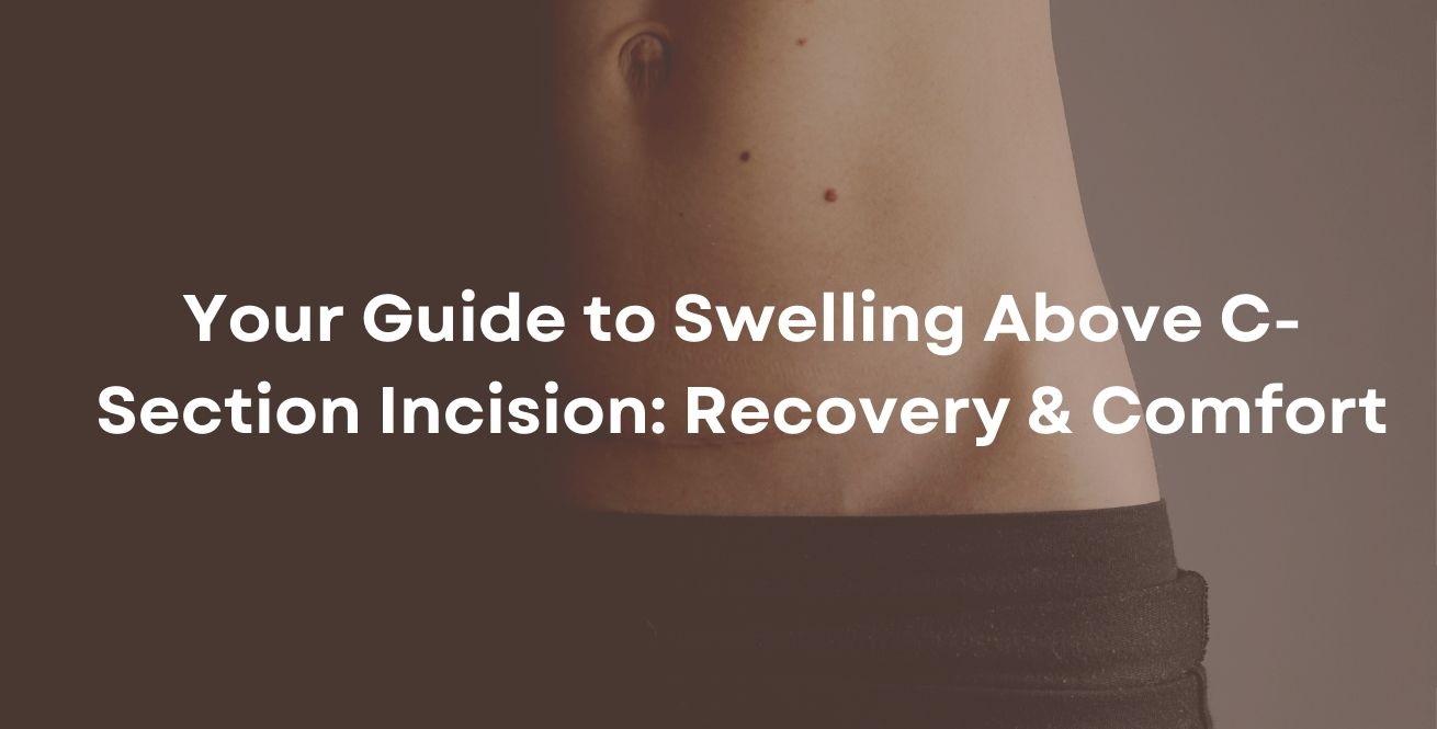Your Guide to Swelling Above C-Section Incision: Recovery & Comfort