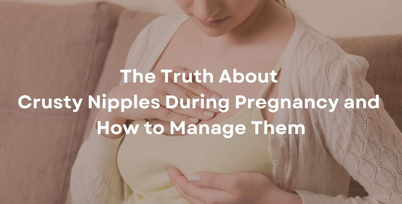 The Truth About Crusty Nipples During Pregnancy and How to Manage Them