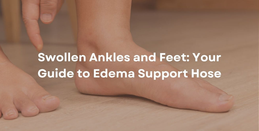 Swollen Ankles and Feet: Your Guide to Edema Support Hose