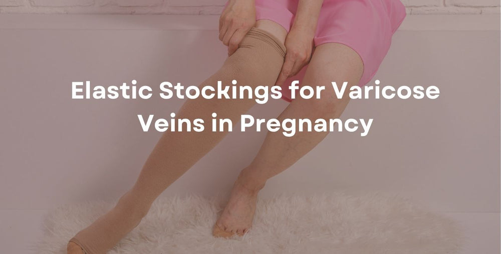 Elastic Stockings for Varicose Veins in Pregnancy