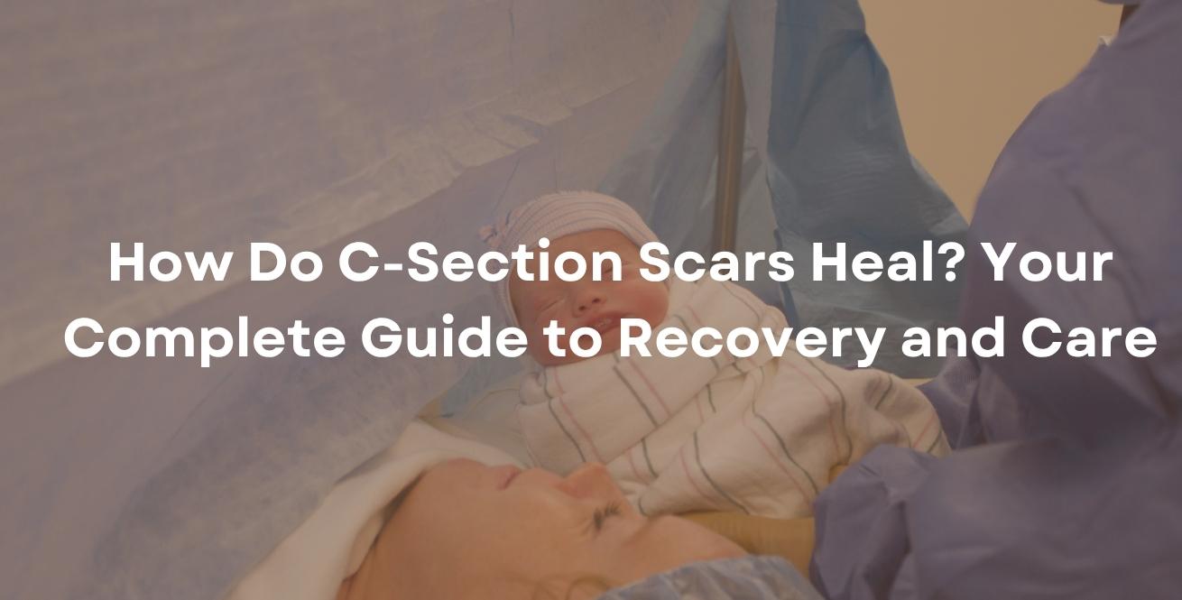 How Do C-Section Scars Heal? Your Complete Guide to Recovery and Care