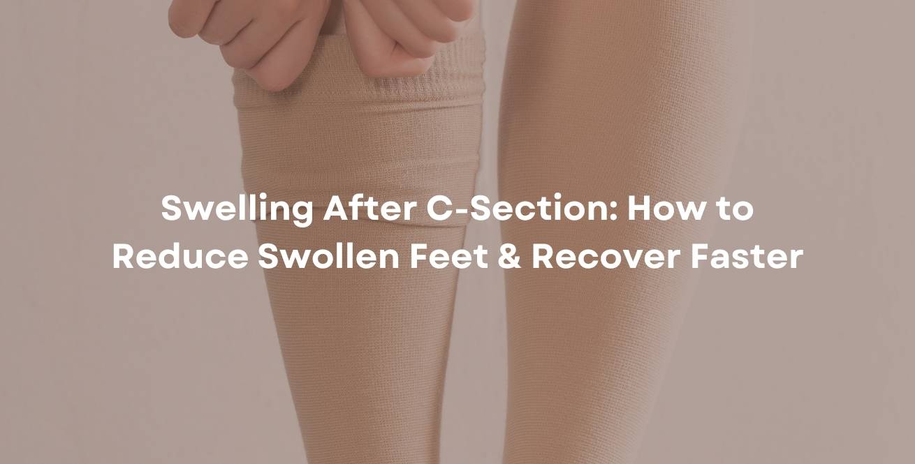 Swelling After C-Section: How to Reduce Swollen Feet & Recover Faster
