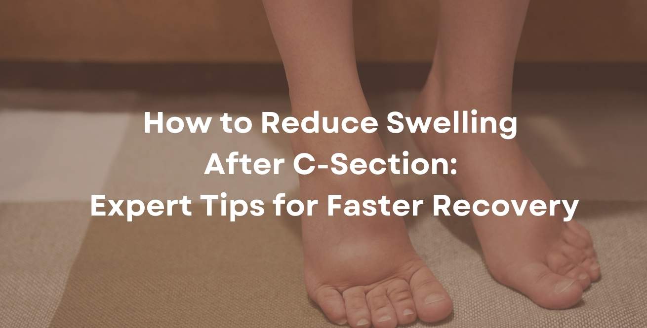 swollen lips after c section How to Reduce Swelling After C-Section: Expert Recovery Tips