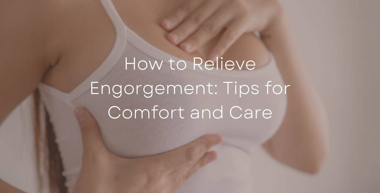 How to Relieve Engorgement: Tips for Comfort and Care