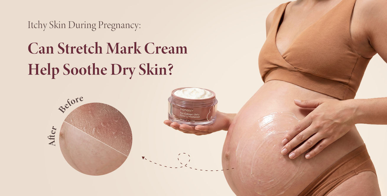 Itchy Skin During Pregnancy: Can Stretch Mark Cream Help Soothe Dry Skin?