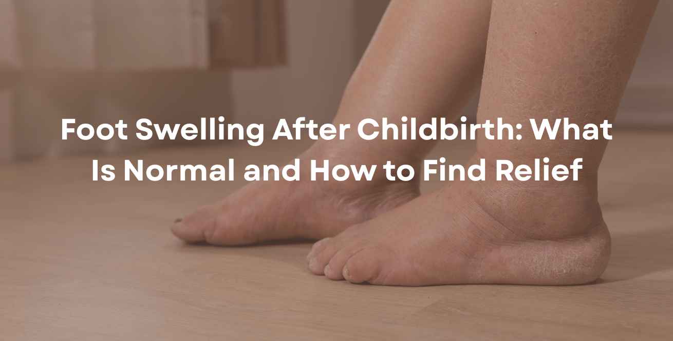 Foot Swelling After Childbirth: What Is Normal and How to Find Relief