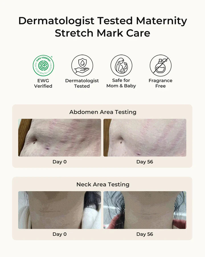 Pregnancy Comfort Bundle:  Stretch Mark Cream, Pregnancy Pillow