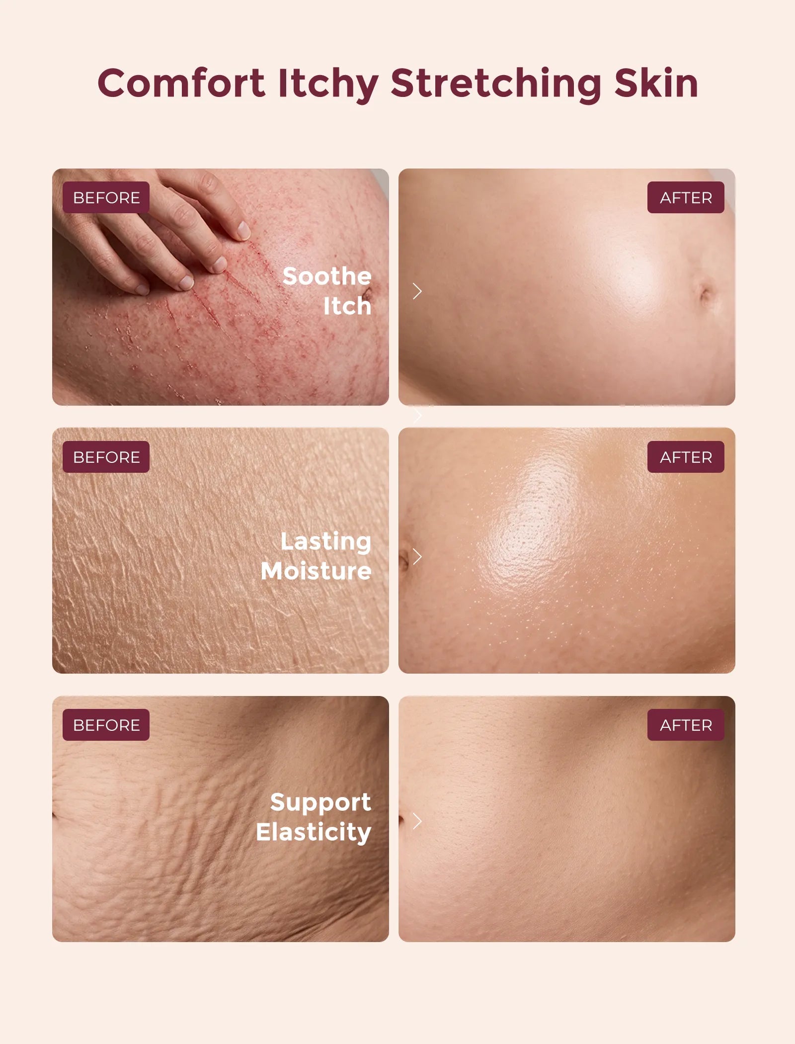 Momcozy Pro-Collagen Belly Firming Moisturizer Stretch Mark Cream